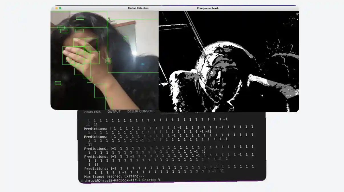 Anomaly Detection Preview
